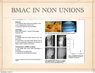 Orthobiologics - PRP, BMC the real story so far! | PDF