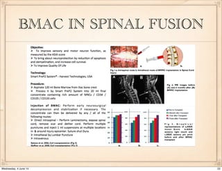 Orthobiologics - PRP, BMC the real story so far! | PDF