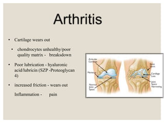 • Cartilage wears out
• chondrocytes unhealthy/poor
quality matrix - breaksdown
• Poor lubrication - hyaluronic
acid/lubricin (SZP -Proteoglycan
4)
• increased friction - wears out
Inflammation - pain
 