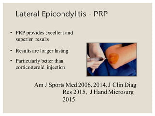 Lateral Epicondylitis - PRP
• PRP provides excellent and
superior results
• Results are longer lasting
• Particularly better than
corticosteroid injection
Am J Sports Med 2006, 2014, J Clin Diag
Res 2015, J Hand Microsurg
2015
 