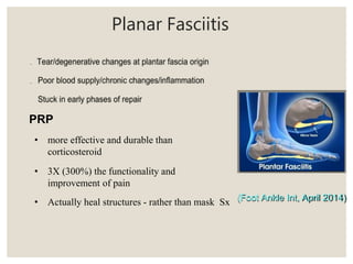 Planar Fasciitis
PRP
• more effective and durable than
corticosteroid
• 3X (300%) the functionality and
improvement of pain
• Actually heal structures - rather than mask Sx (Foot Ankle Int, April 2014)
 