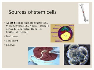 Sources of stem cells
◦ Adult Tissue: Hematopoeitic SC,
Mesenchymal SC, Neural, muscle
derived, Pancreatic, Hepatic,
Epithelial, Dental.
◦ Fetal tissue
◦ Cord blood
◦ Embryos
 