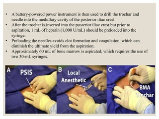 • A battery-powered power instrument is then used to drill the trochar and
needle into the medullary cavity of the posterior iliac crest
• After the trochar is inserted into the posterior iliac crest but prior to
aspiration, 1 mL of heparin (1,000 U/mL) should be preloaded into the
syringe.
• Preloading the needles avoids clot formation and coagulation, which can
diminish the ultimate yield from the aspiration.
• Approximately 60 mL of bone marrow is aspirated, which requires the use of
two 30-mL syringes.
 