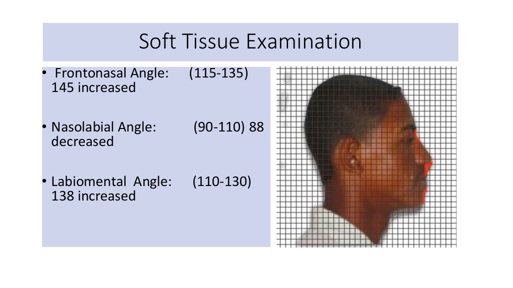 orthodontic case presentation