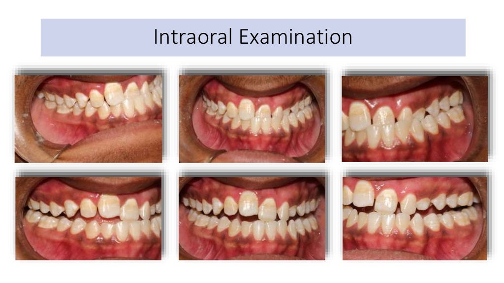 orthodontic case presentation