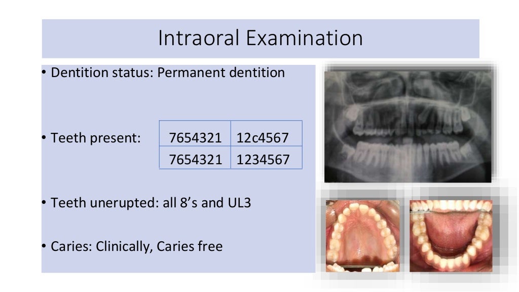 orthodontic case presentation