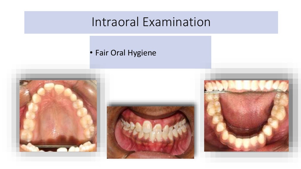 orthodontic case presentation