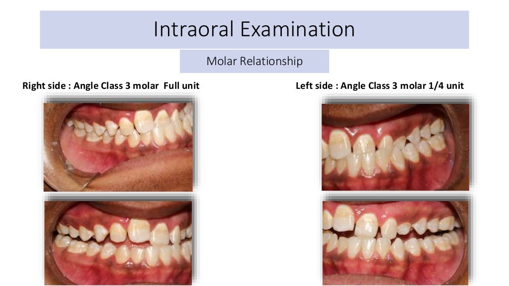 orthodontic case presentation