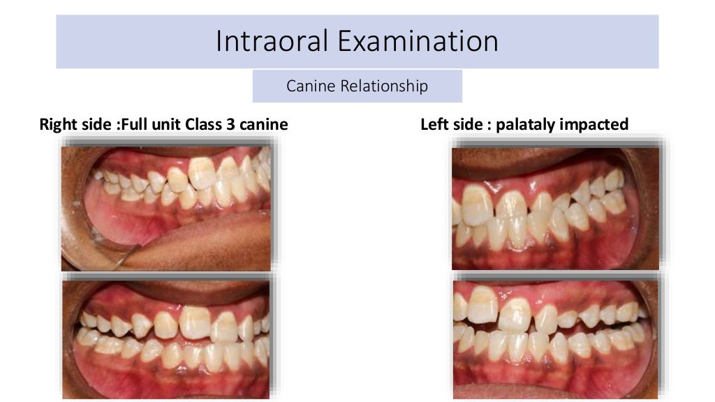 orthodontic case presentation