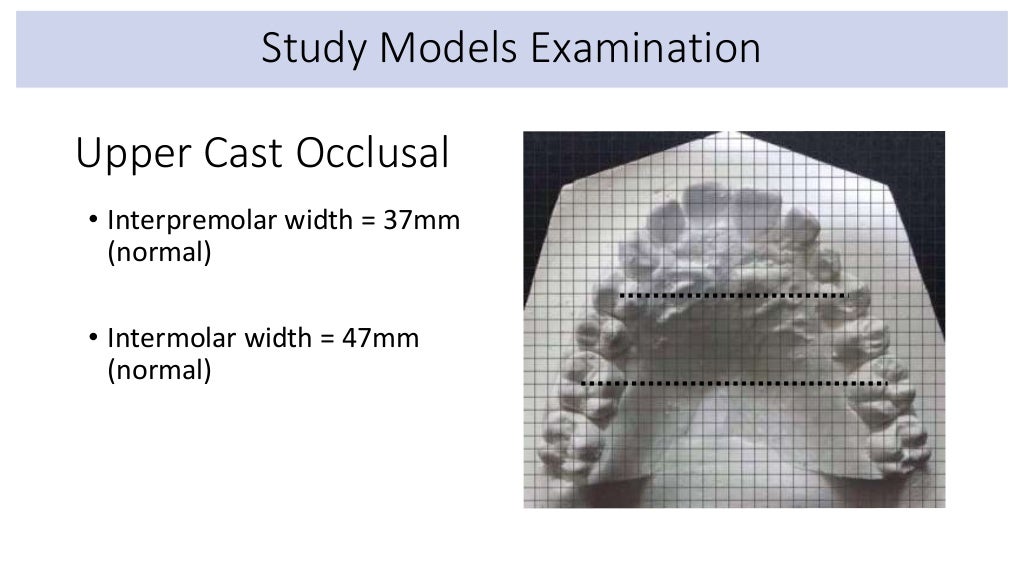 orthodontic case presentation