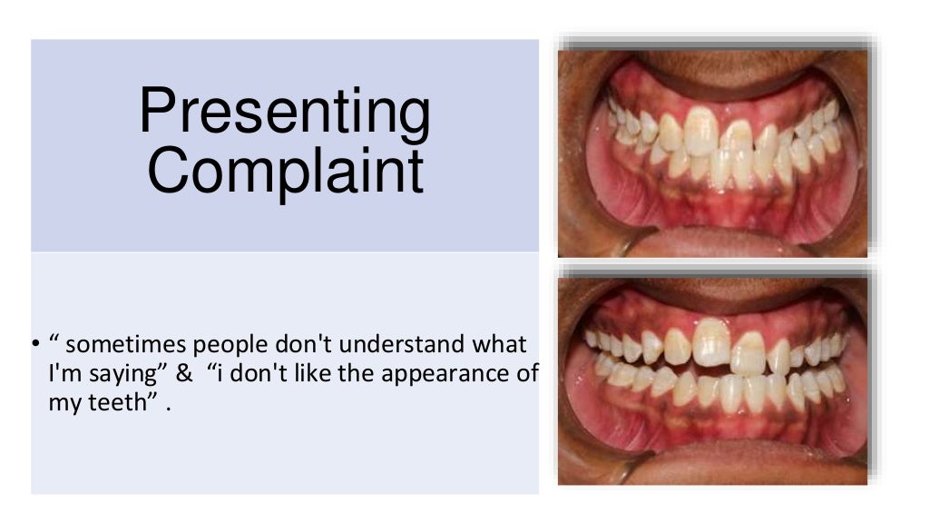 orthodontic case presentation