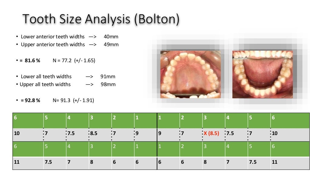 orthodontic case presentation