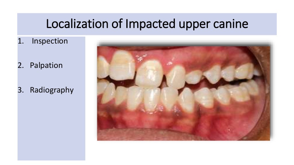 orthodontic case presentation