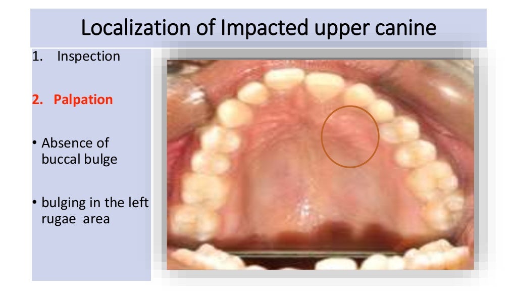 orthodontic case presentation