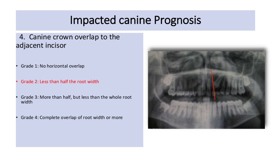 orthodontic case presentation