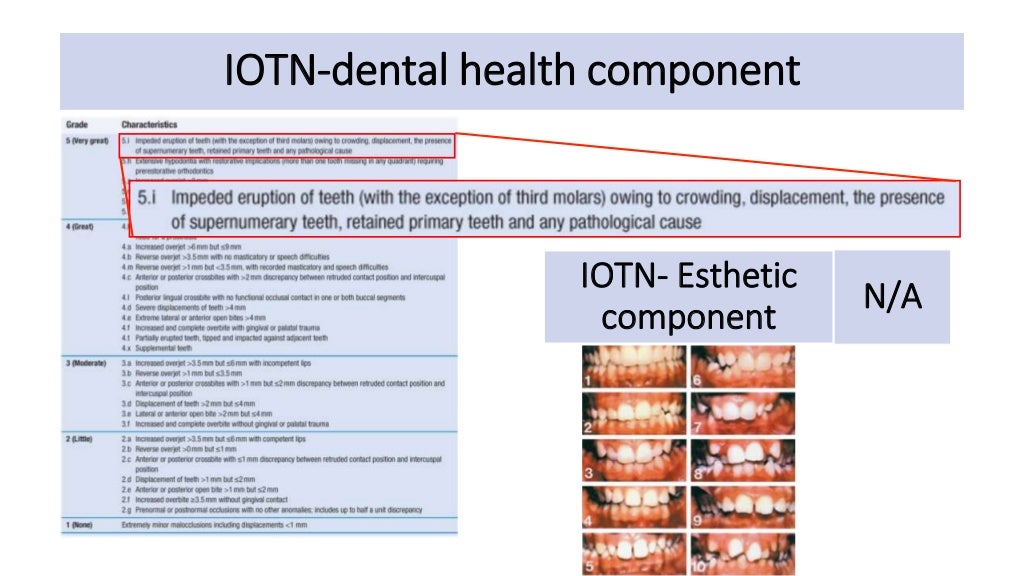 orthodontic case presentation