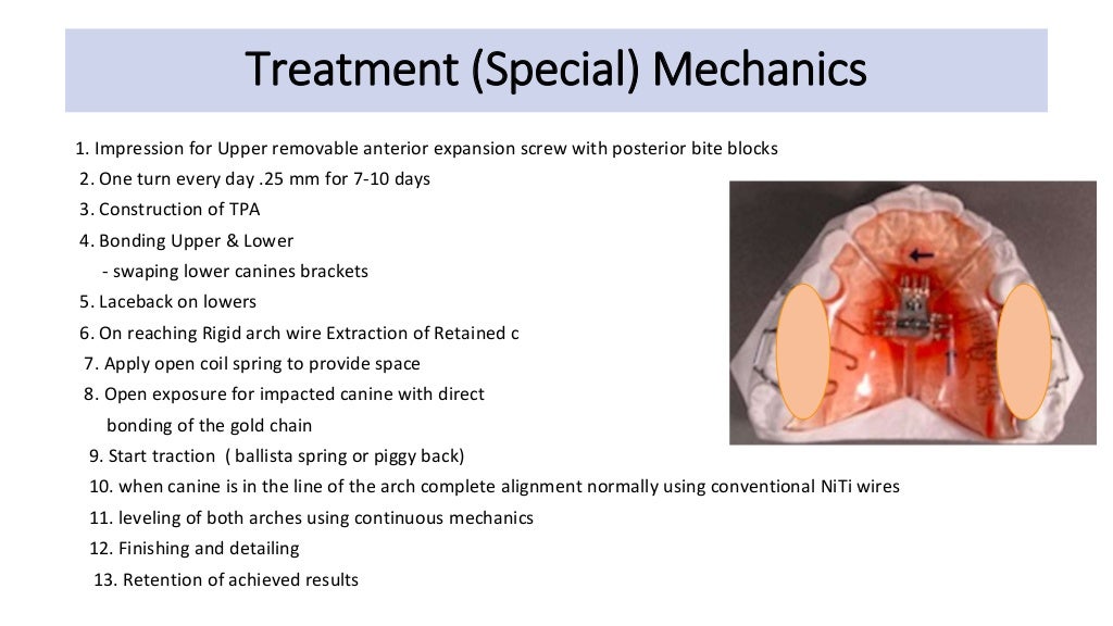 orthodontic case presentation
