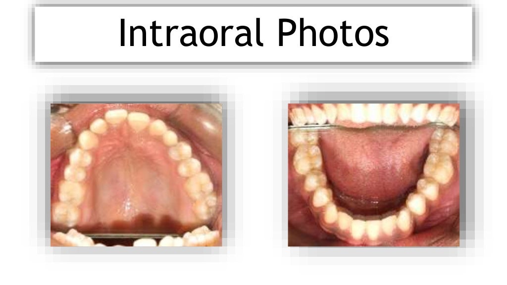 orthodontic case presentation