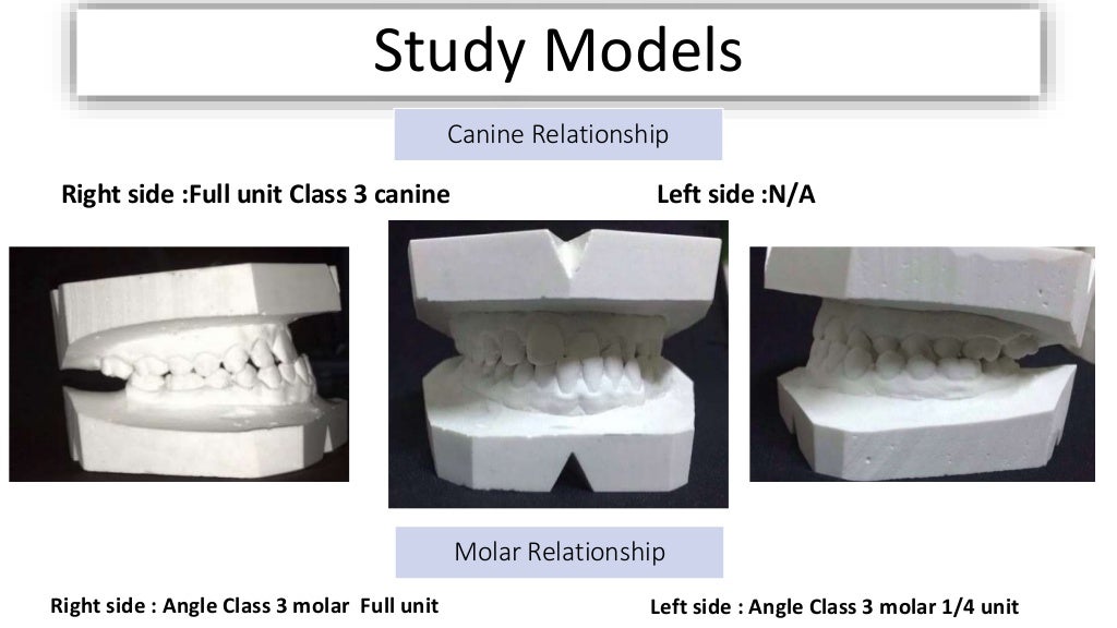 orthodontic case presentation