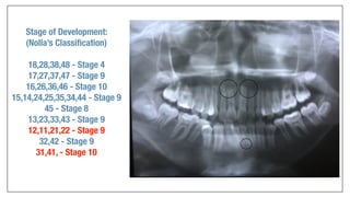 Orthodontics Case Analysis