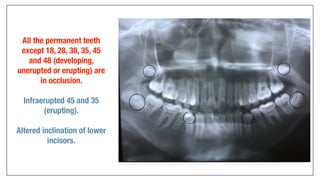 Orthodontics Case Analysis