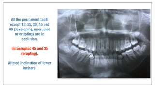 Orthodontics Case Analysis
