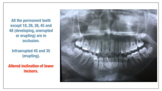 Orthodontics Case Analysis