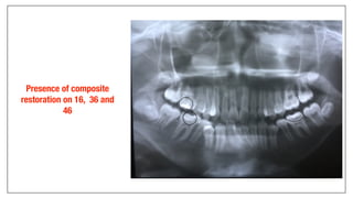 Orthodontics Case Analysis