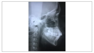 Orthodontics Case Analysis