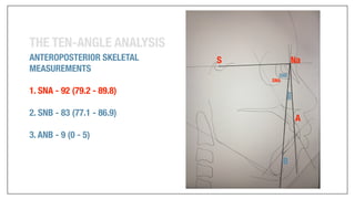 Orthodontics Case Analysis