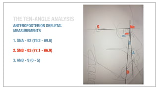 Orthodontics Case Analysis