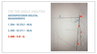Orthodontics Case Analysis