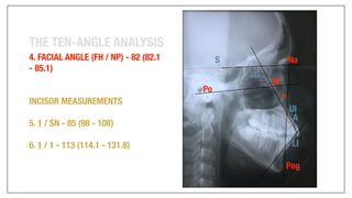 Orthodontics Case Analysis