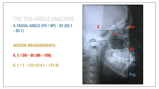Orthodontics Case Analysis