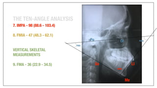 Orthodontics Case Analysis
