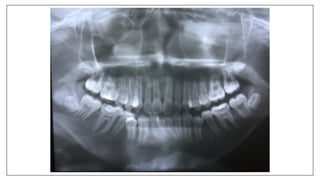 Orthodontics Case Analysis