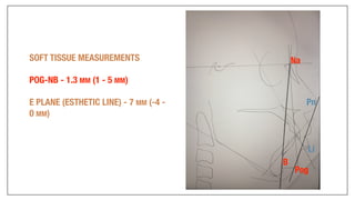 Orthodontics Case Analysis