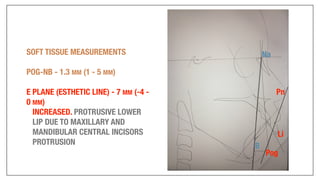 Orthodontics Case Analysis