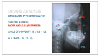 Orthodontics Case Analysis