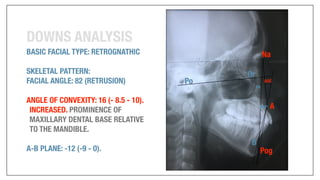 Orthodontics Case Analysis
