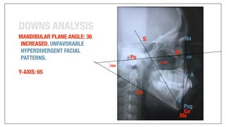 Orthodontics Case Analysis