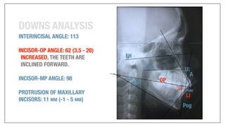 Orthodontics Case Analysis