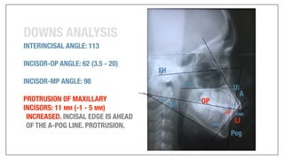 Orthodontics Case Analysis