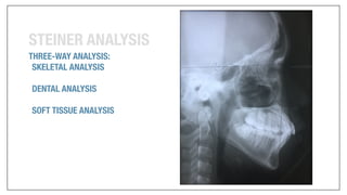 Orthodontics Case Analysis