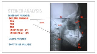 Orthodontics Case Analysis