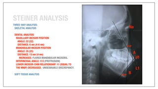 Orthodontics Case Analysis