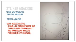 Orthodontics Case Analysis
