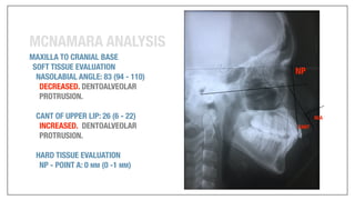 Orthodontics Case Analysis