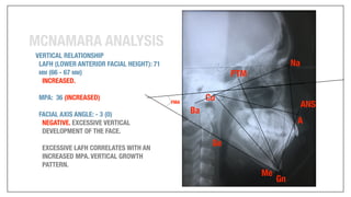 Orthodontics Case Analysis