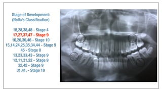 Orthodontics Case Analysis